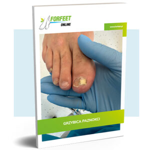 Ebook: Terapia Grzybicy