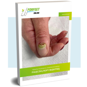 Ebook: Terapia Pałeczki Ropy Błękitnej